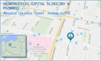 PORADNIA LECZENIA JASKRY - UNIWERSYTECKI SZPITAL KLINICZNY W POZNANIU - AUGUSTYNA SZAMARZEWSKIEGO 84,  POZNAŃ-JEŻYCE